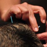 Natural Pet-Acupuncture For Pet Healthcare